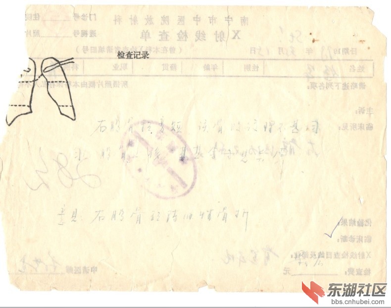 截图：（扫）右股骨颈变短 股骨上移 南宁市中医院X射线检查单 1999.1.15.jpg.jpg