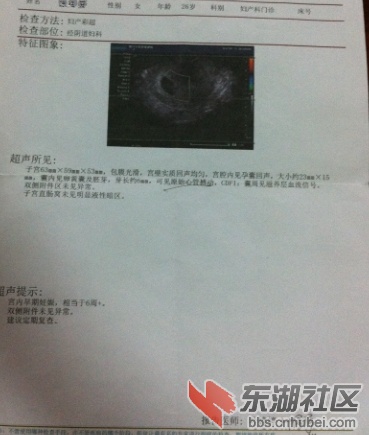 QK1KF_0(Q9`_ITU]F362}DI.jpg