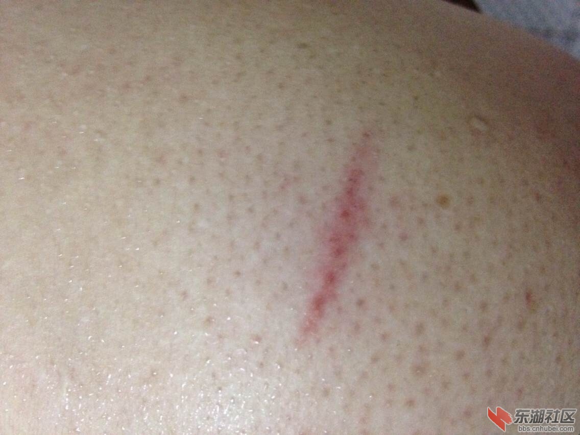 身体伤害图片2.jpg