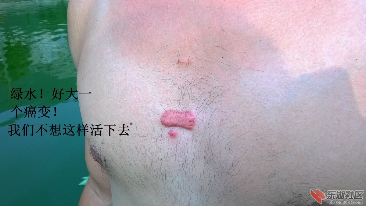 可怕的近距离污染带来的灾难