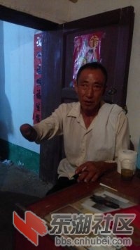 因公受伤失去的胳膊和一只眼睛