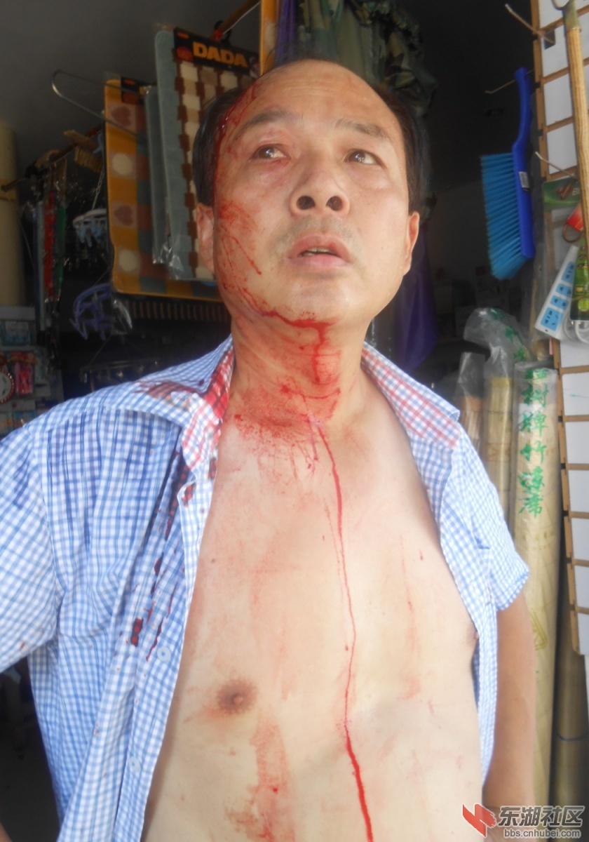 等待交警到来的赵某