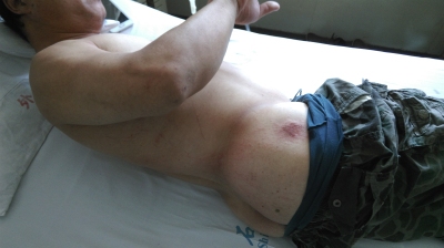 伤情B.jpg