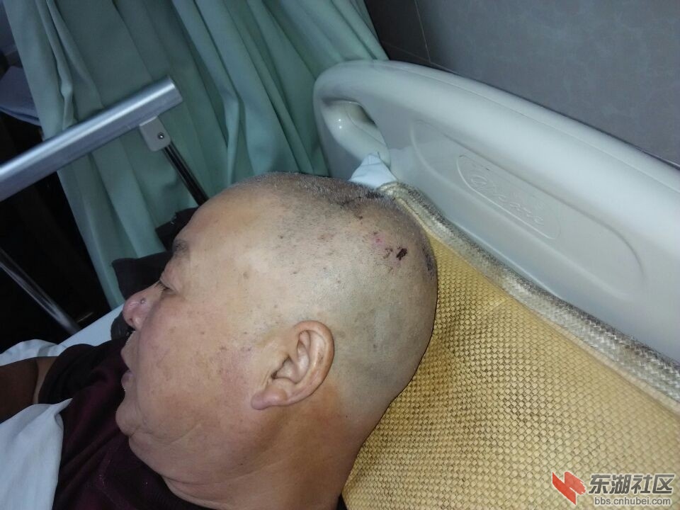 头部的伤痕