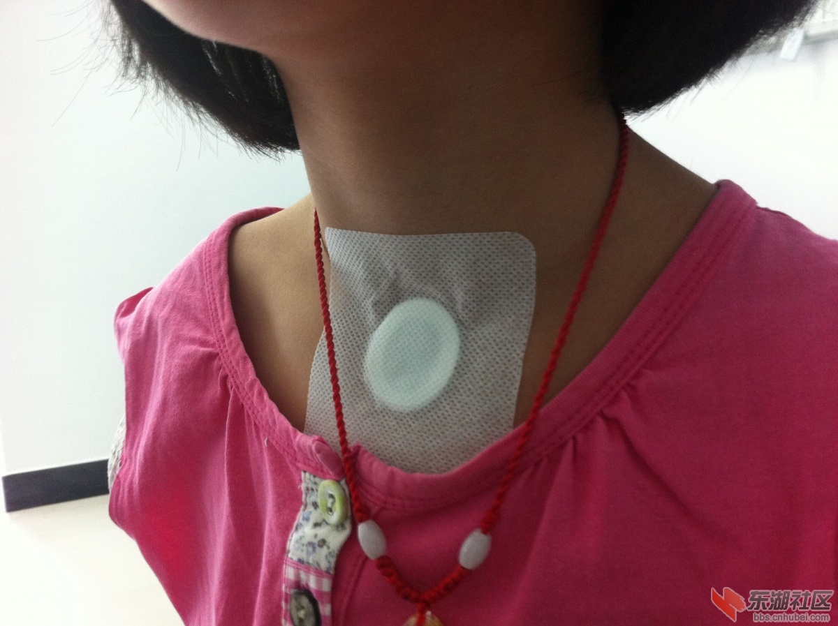 给患者进行穴位贴敷